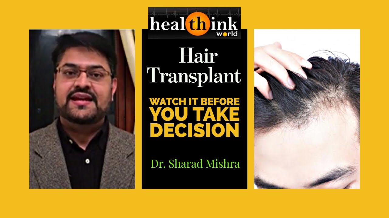 Hair transplant - watch this video before taking decision