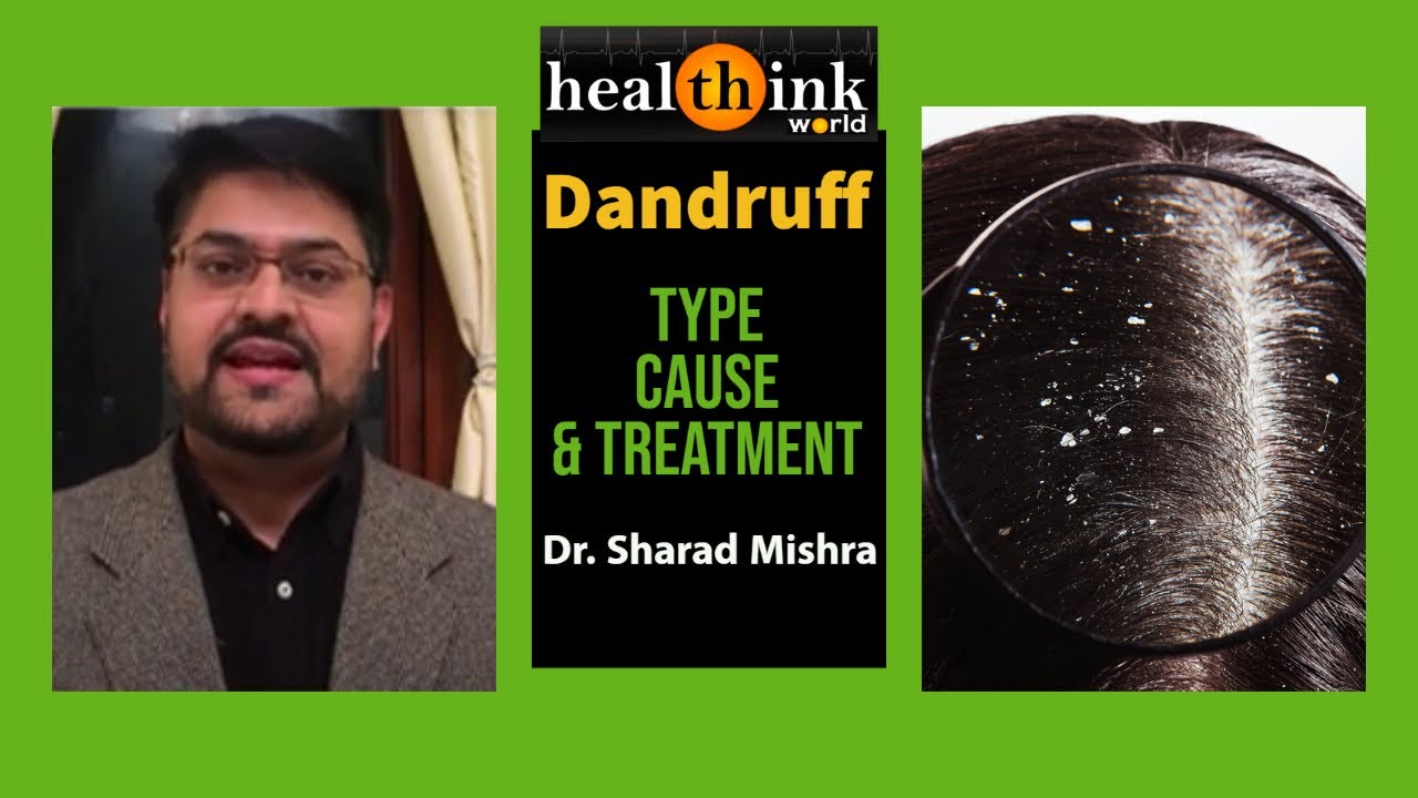 Dandruff - different types need different treatment