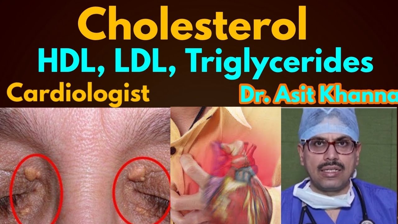 High cholesterol, HDL, LDL, Triglycerides - facts and way to reduce it