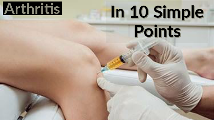 Understand Arthritis in 10 Simple Points