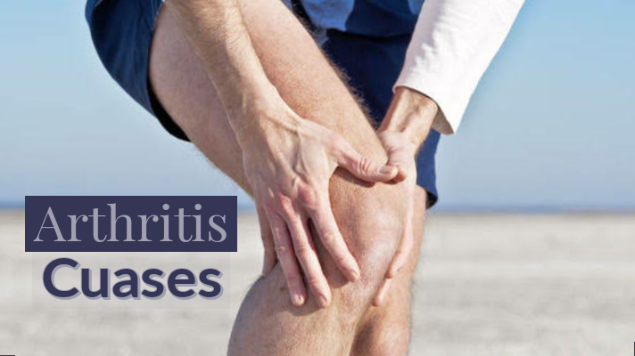 10 Reason of Arthritis 